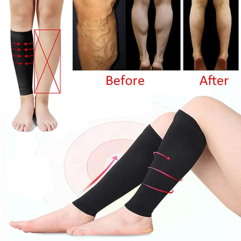 Elastic Knee High Stockings Calf Compression Stockings Varicose Veins Treat Shaping Graduated Pressure Medical Slim Socks – Medical Grade Compression Socks for Support Sockology